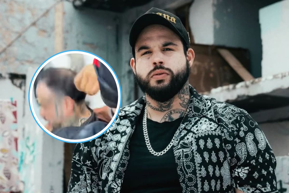 Emiliano Aguilar bromea sobre su calvicie tras pelea viral: “Lo único que me c*ga” (VIDEO)