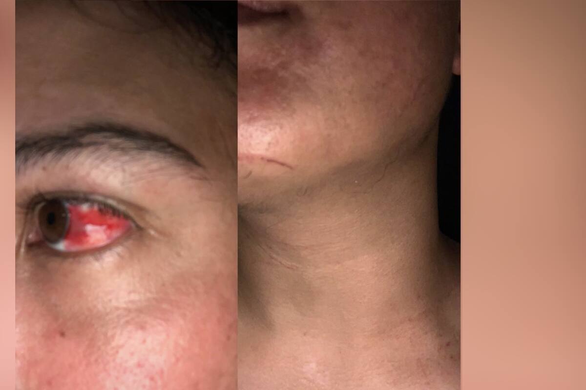 Joven denuncia a restaurante de Hermosillo; asegura que propietario y trabajadores los golpearon
