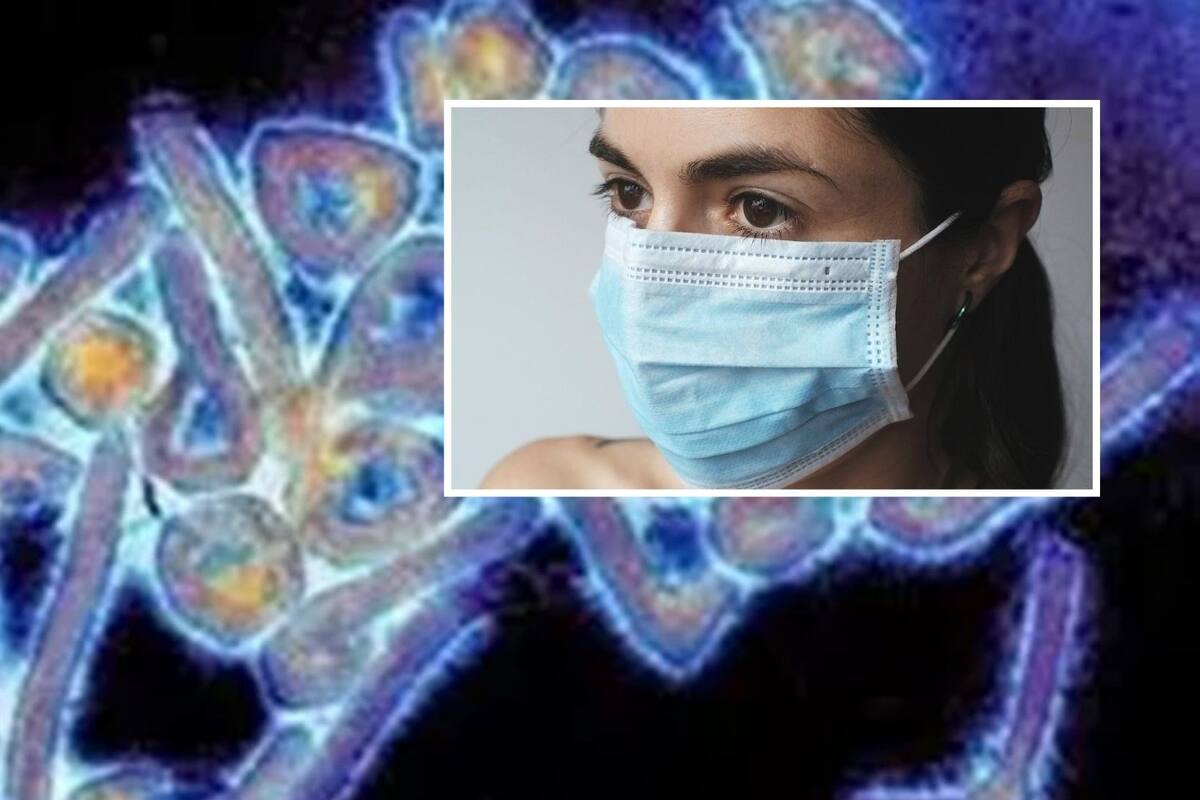 Marburgo: OMS en alerta ante posible propagación de virus mortal en África