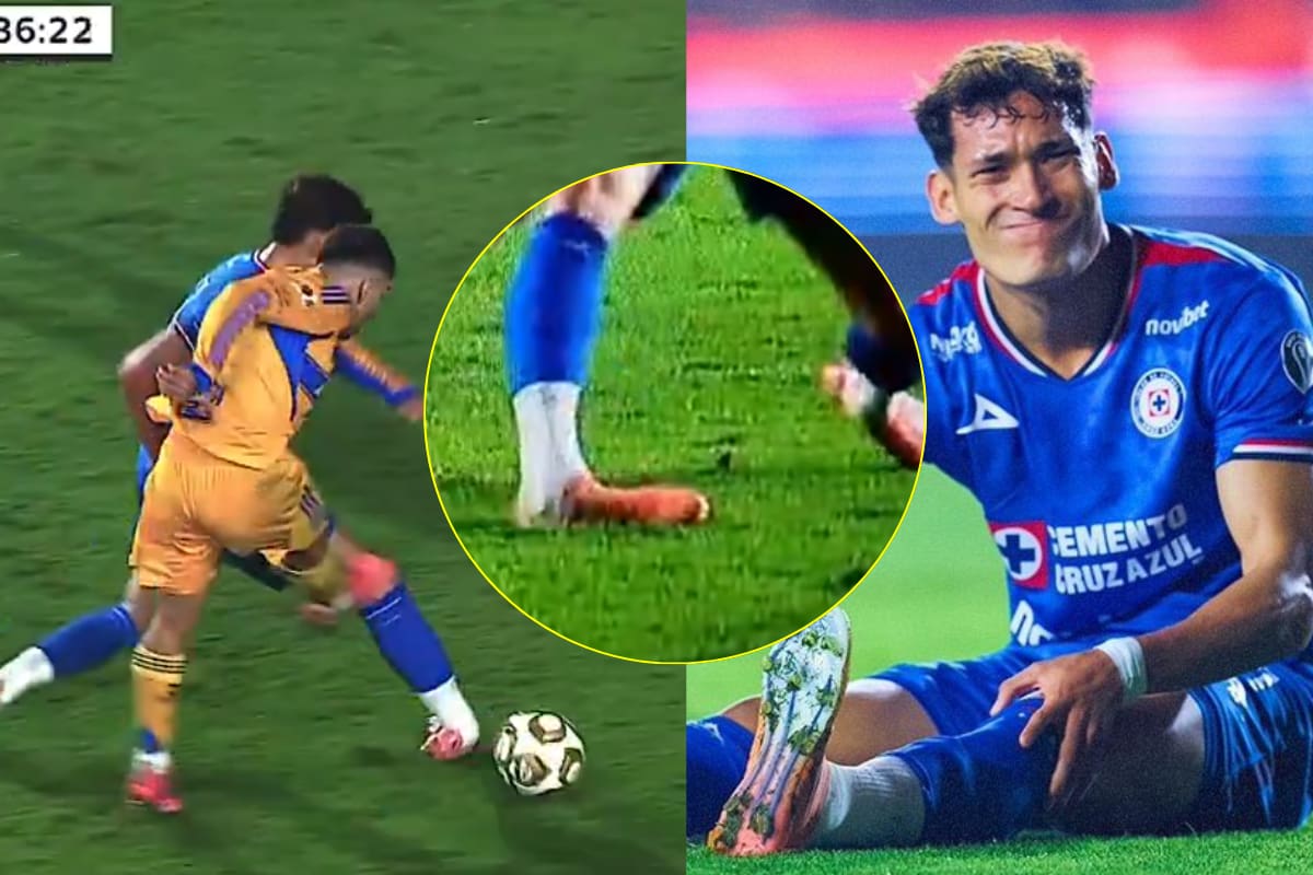 ¿Qué lesión sufrió Orozco Chiquete, defensa de Cruz Azul? Esto es lo que se sabe