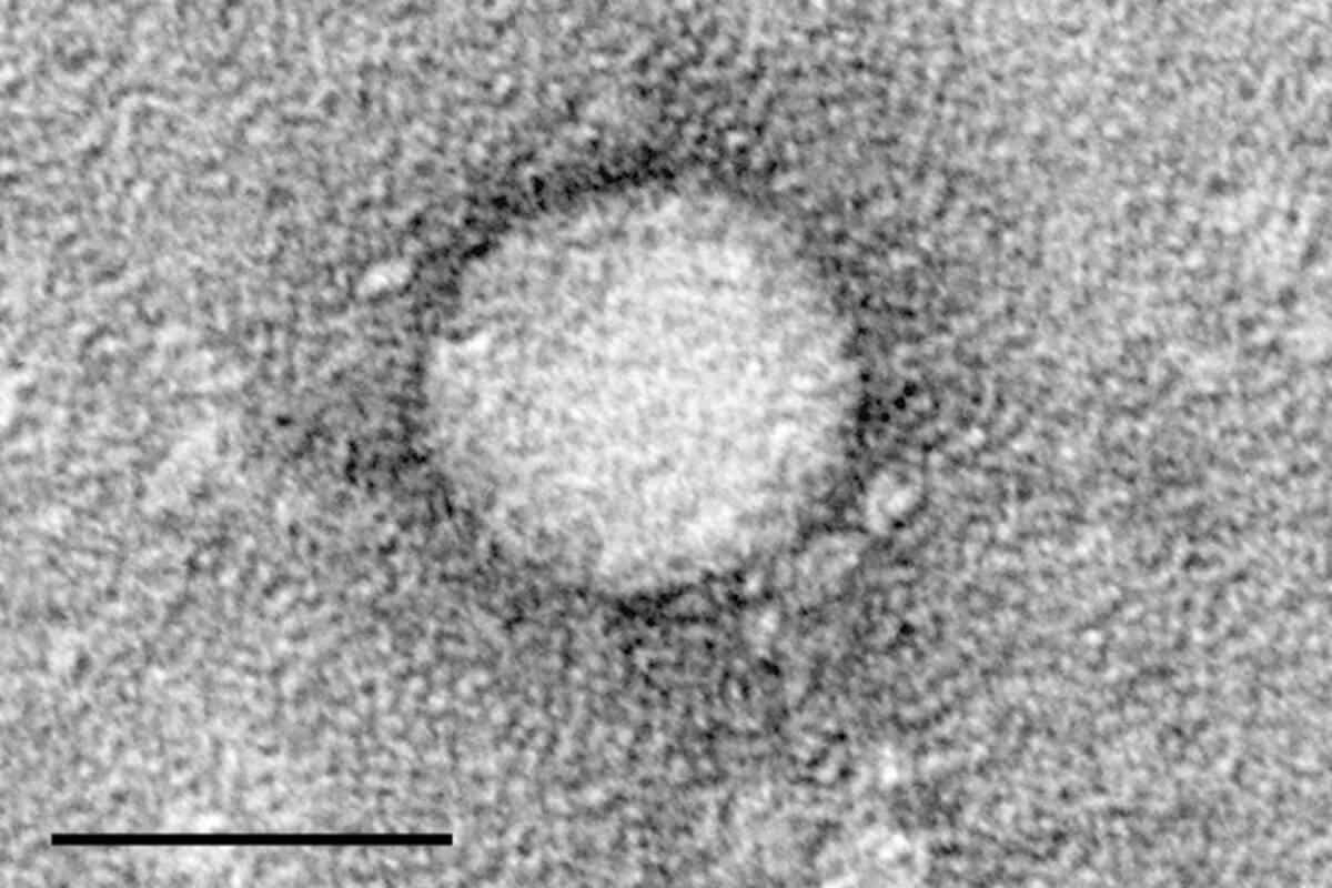 Los científicos descubrieron la estructura de la proteína clave para una futura vacuna contra la hepatitis C: Así es como lo hicieron