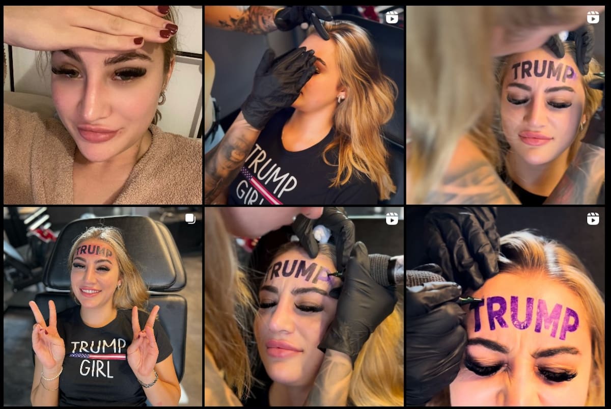 Tatuaje de "Trump" en la frente. Foto: Captura/Instagram