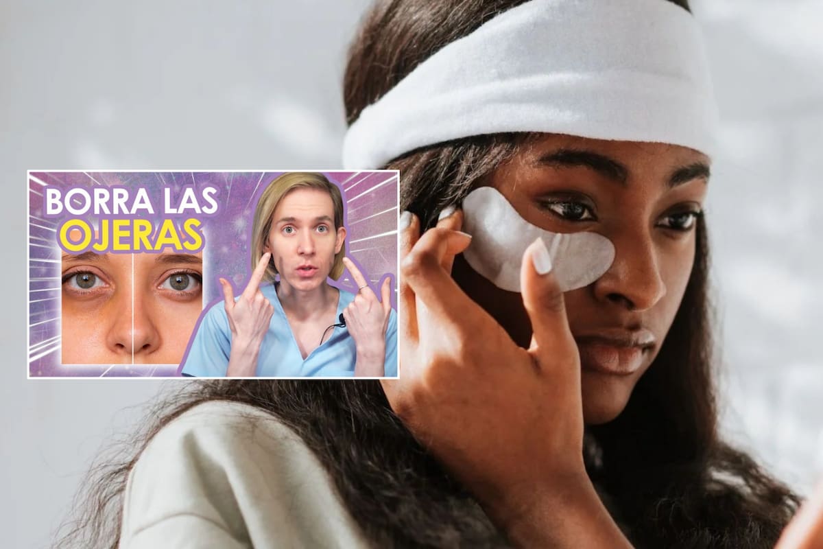 ¿Cómo eliminar las ojeras? Tipos, causas y tratamientos efectivos