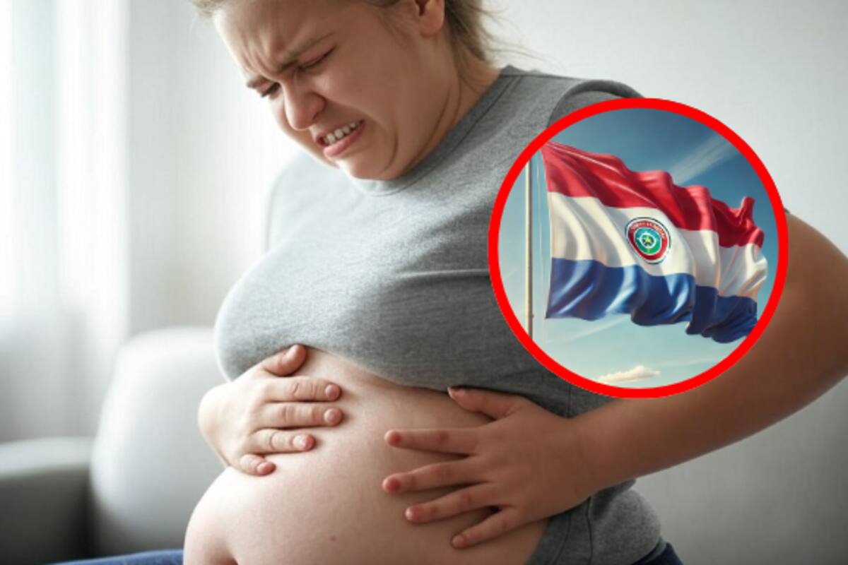 Extraen un quiste de ovario de 12 kilos que deformaba el abdomen de una joven en Paraguay