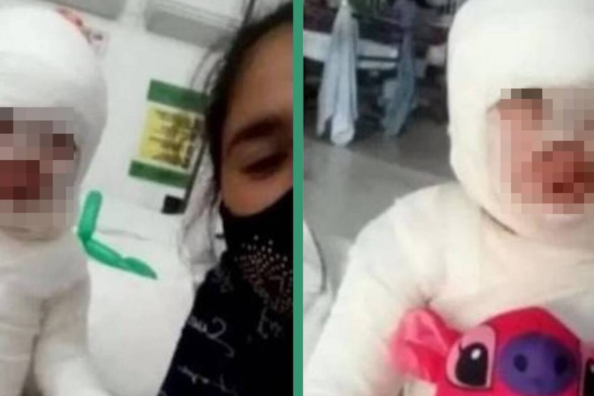 "Ni disculpas pidieron": Mesera tira aceite hirviendo a niña de 3 años