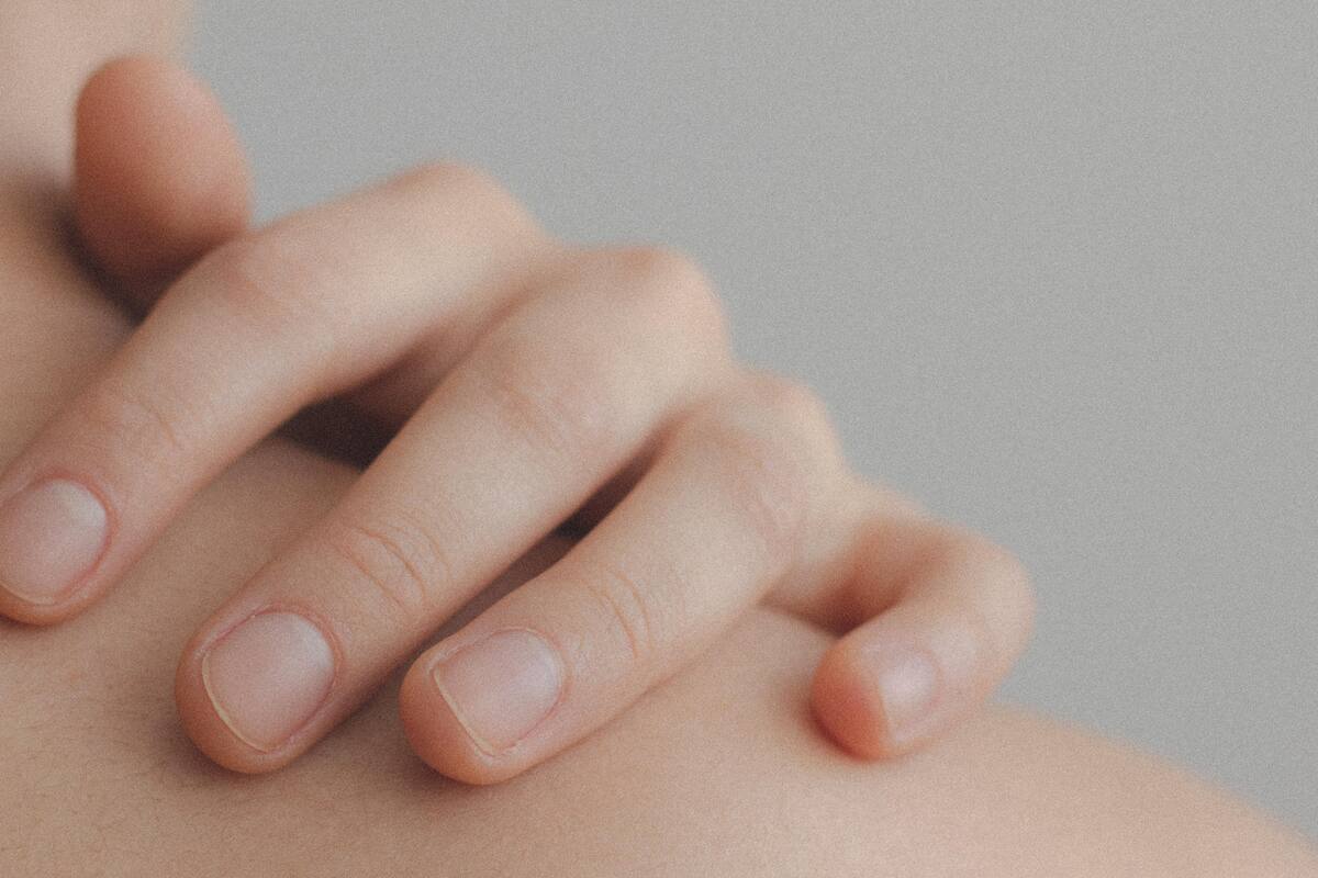 Día mundial contra el melanoma: ¿Cómo prevenir el melanoma?