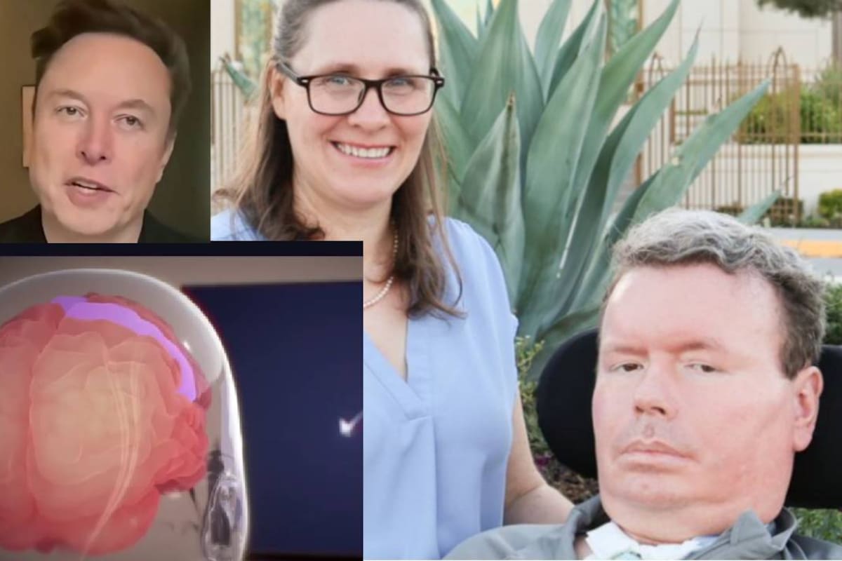 Bradford Smith, es el primer paciente con ELA que volvió a comunicarse por voz a través de la IA gracias a un implante cerebral de Neuralink