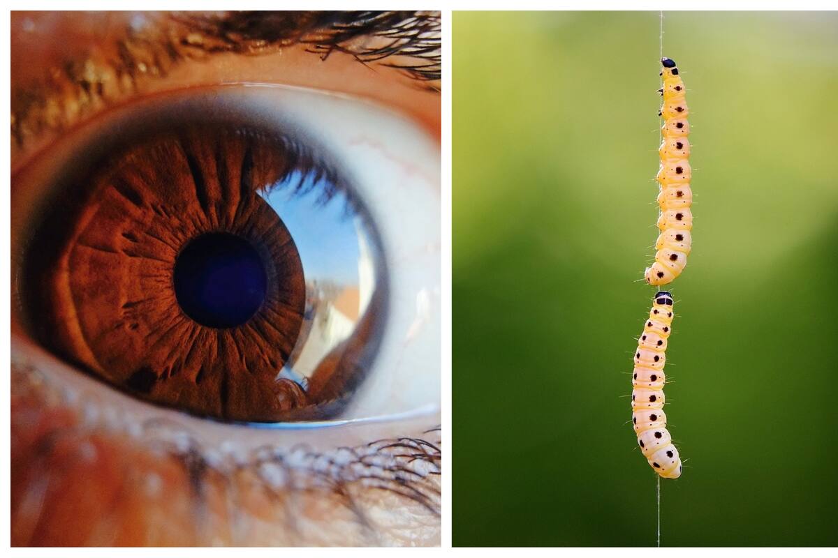 Miasis: Extirpan larvas de mosca de un ojo a una mujer luego de sentir que "algo se movía"