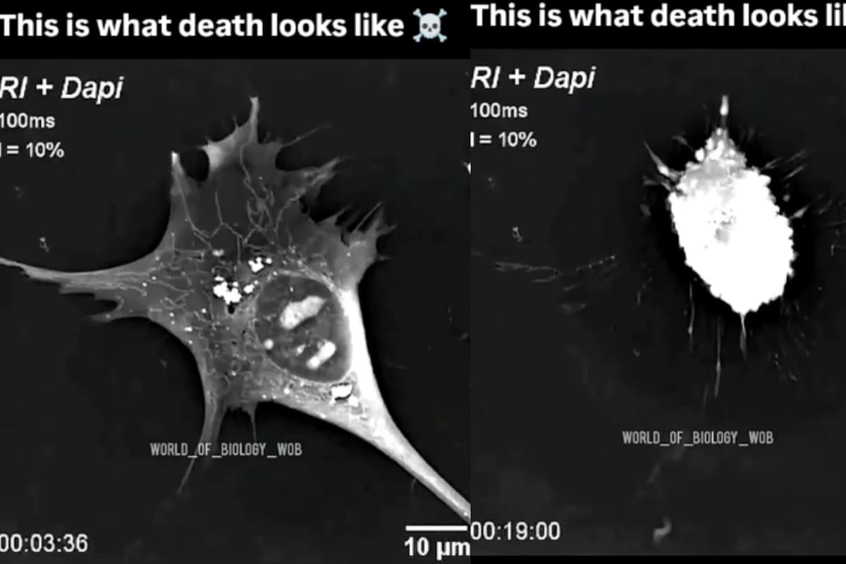 “Así es como se ve la muerte”: Proceso celular se vuelve viral al mostrar cuando las células dejan de existir