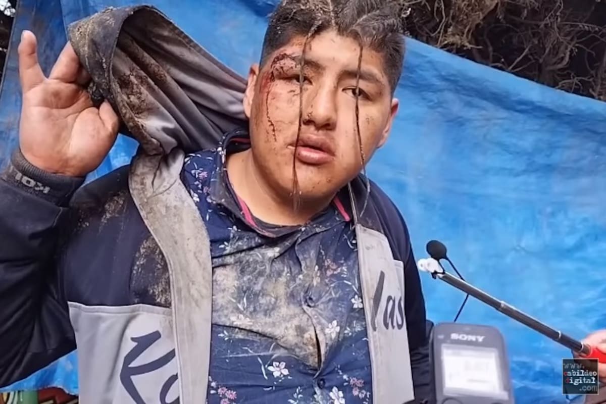 "Me querían ofrendar": Hombre sale de fiesta y termina enterrado vivo