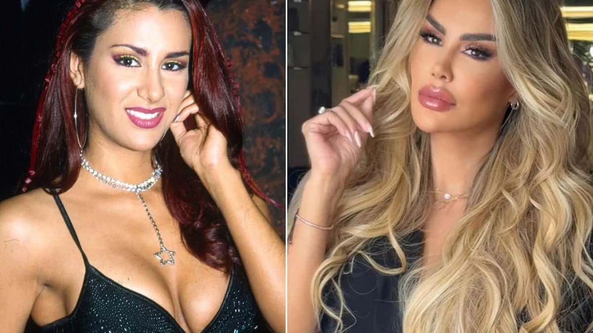 Ninel Conde: Antes y después.