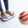 Tener menos dientes se asocia con mayor aumento de peso, advierte estudio en el que señala cambios en la alimentación y efectos en la salud general