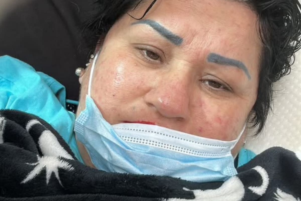 Organizan venta de barbacoa solidaria para costear quimioterapias de Gehira Margot, paciente oncológica