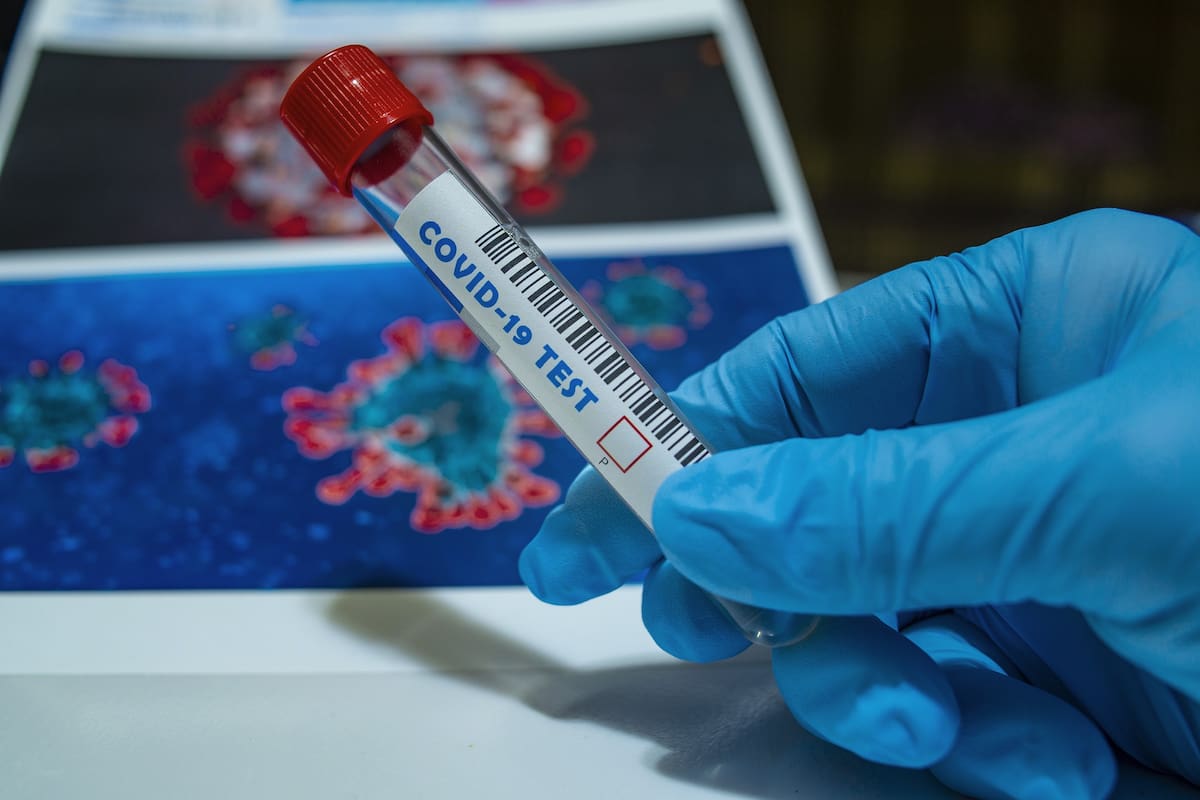 Expertos advierten que si Salud no modifica plan, la pandemia no cederá