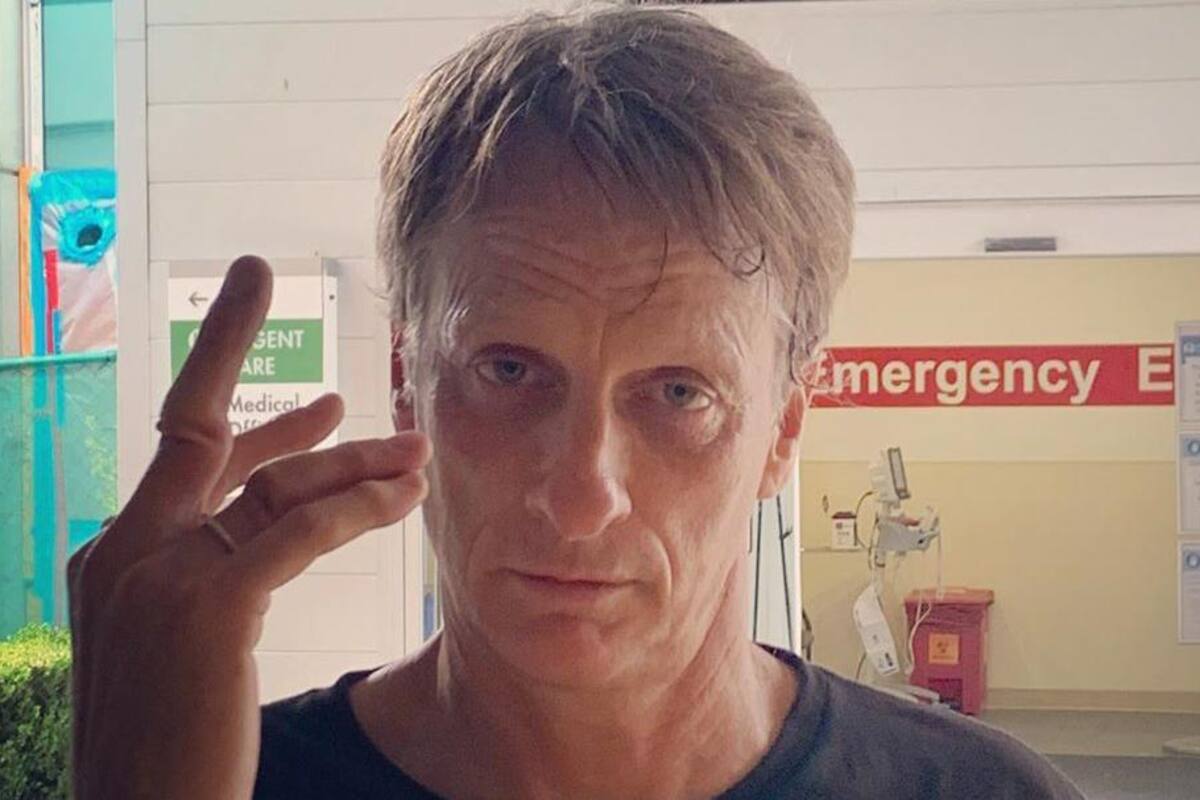 Tony Hawks sufrió fractura en sus dedos y le rompieron el anillo de bodas