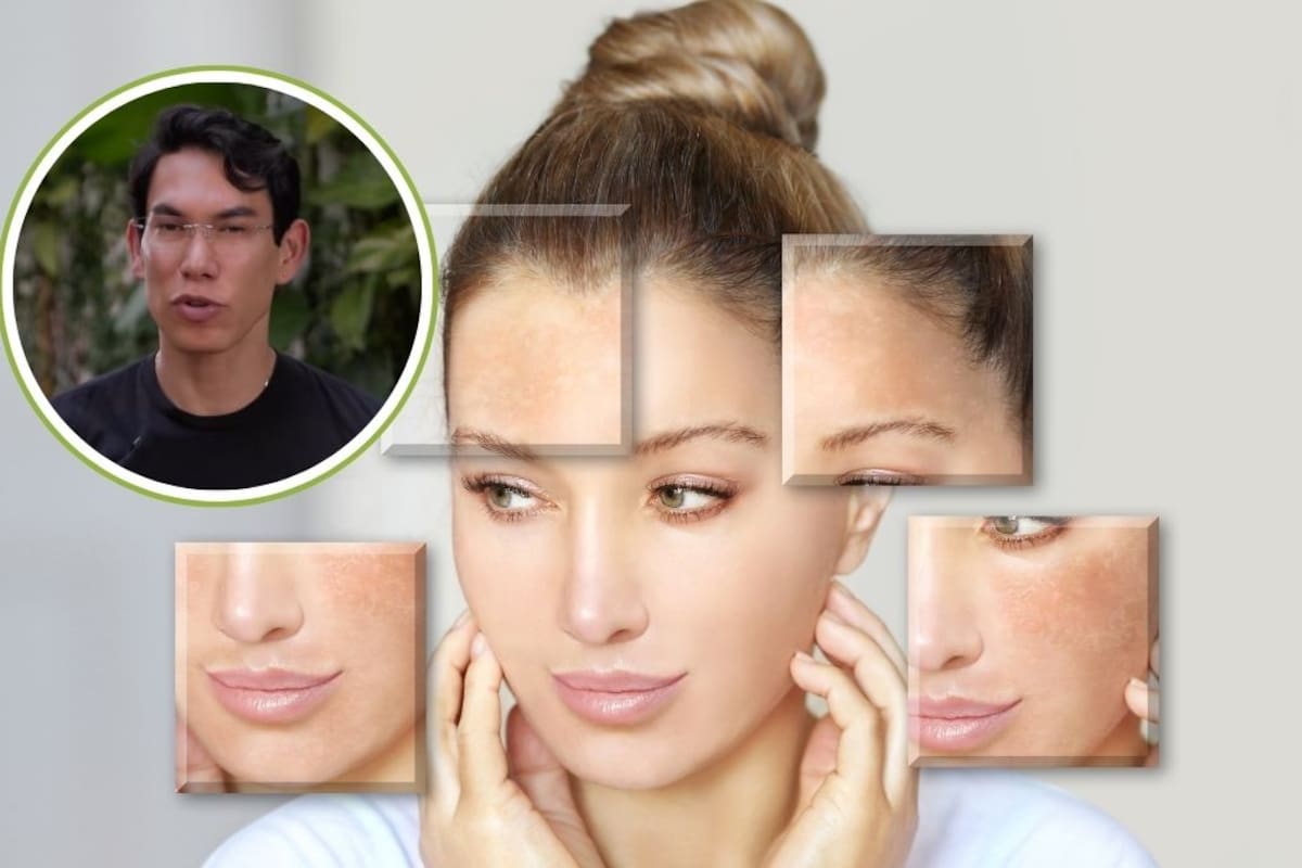 Un dermatólogo que comparte consejos de cuidado de la piel en TikTok recomienda tres productos y líneas de farmacia para disminuir manchas oscuras en el rostro y el cuerpo