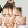 Un dermatólogo que comparte consejos de cuidado de la piel en TikTok recomienda tres productos y líneas de farmacia para disminuir manchas oscuras en el rostro y el cuerpo