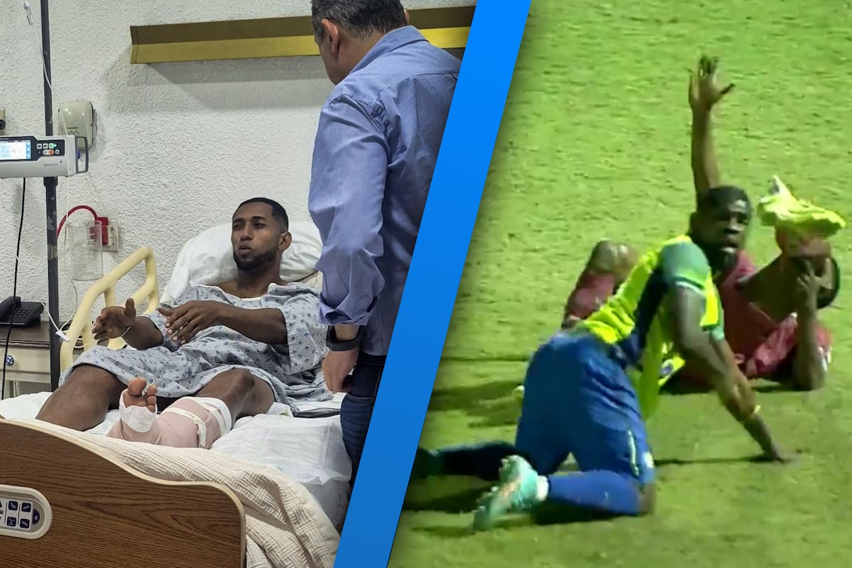 ¿Podrá volver a jugar? Así fue la espeluznante lesión de Romario Da Silva en el futbol hondureño