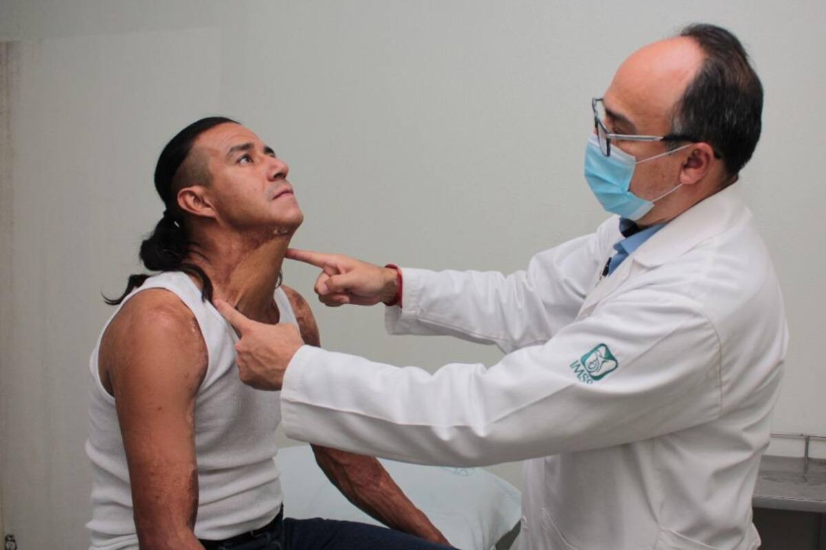 Especialistas del IMSS rehabilitan a paciente que sufrió quemaduras por descarga eléctrica