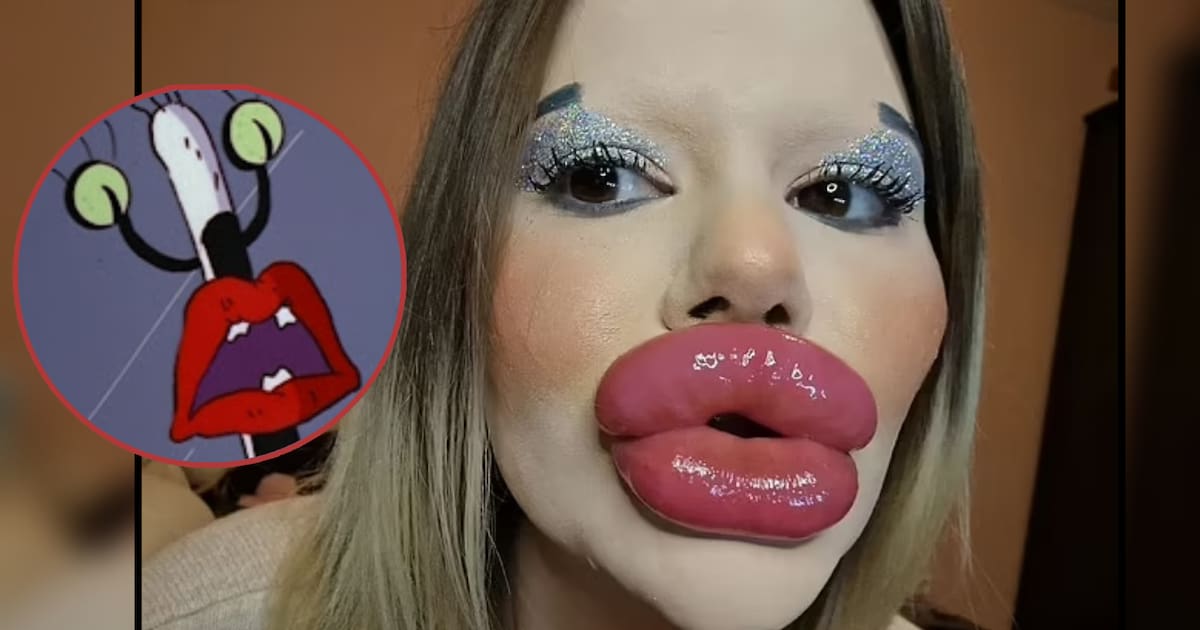 Labiaos FOTOS: Mujer con los labios más grandes del mundo ahora busca un nuevo ...