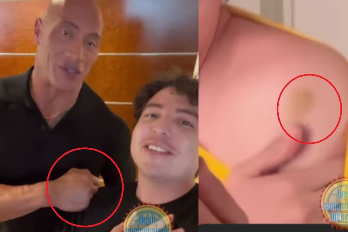 Joven muestra el moretón que le dejó Dwayne Johnson con solo un saludo, sorprendiendo por su fuerza