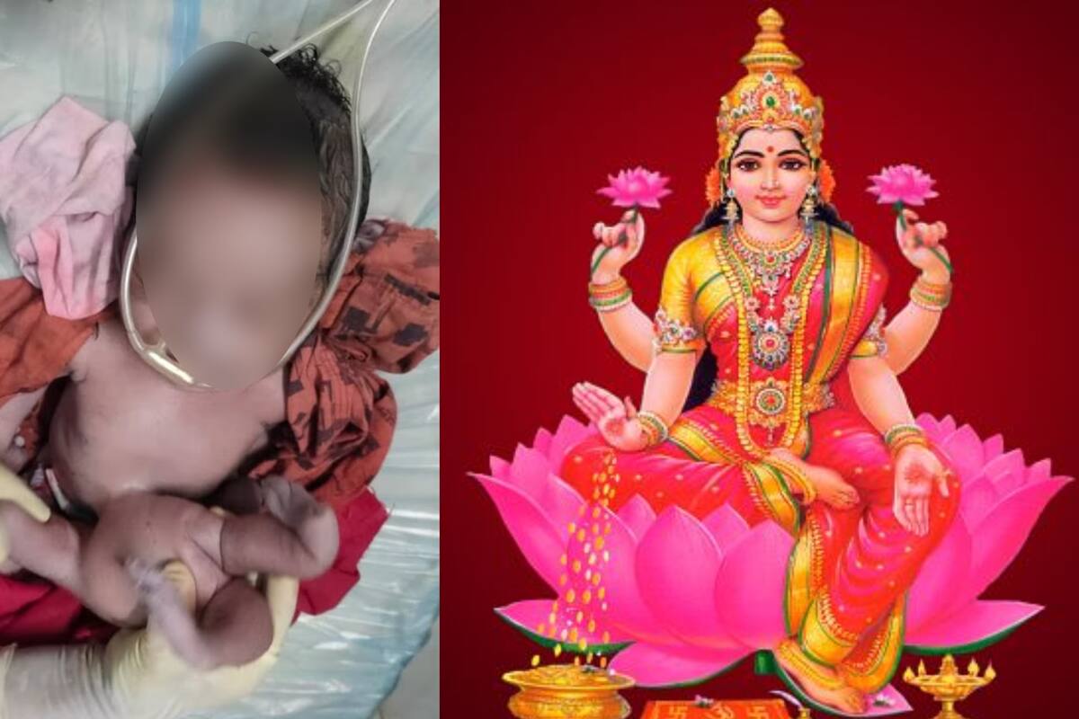 India: Bebé nace con cuatro brazos y cuatro piernas; dicen que podría ser una reencarnación de la diosa Lakshmi