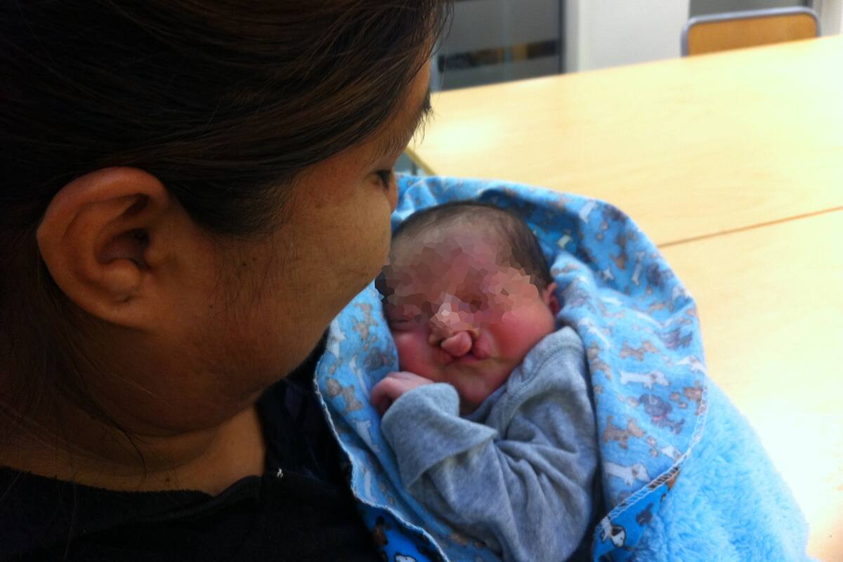 Fundación UABC impulsará creación de hospital para tratar labio y paladar hendido