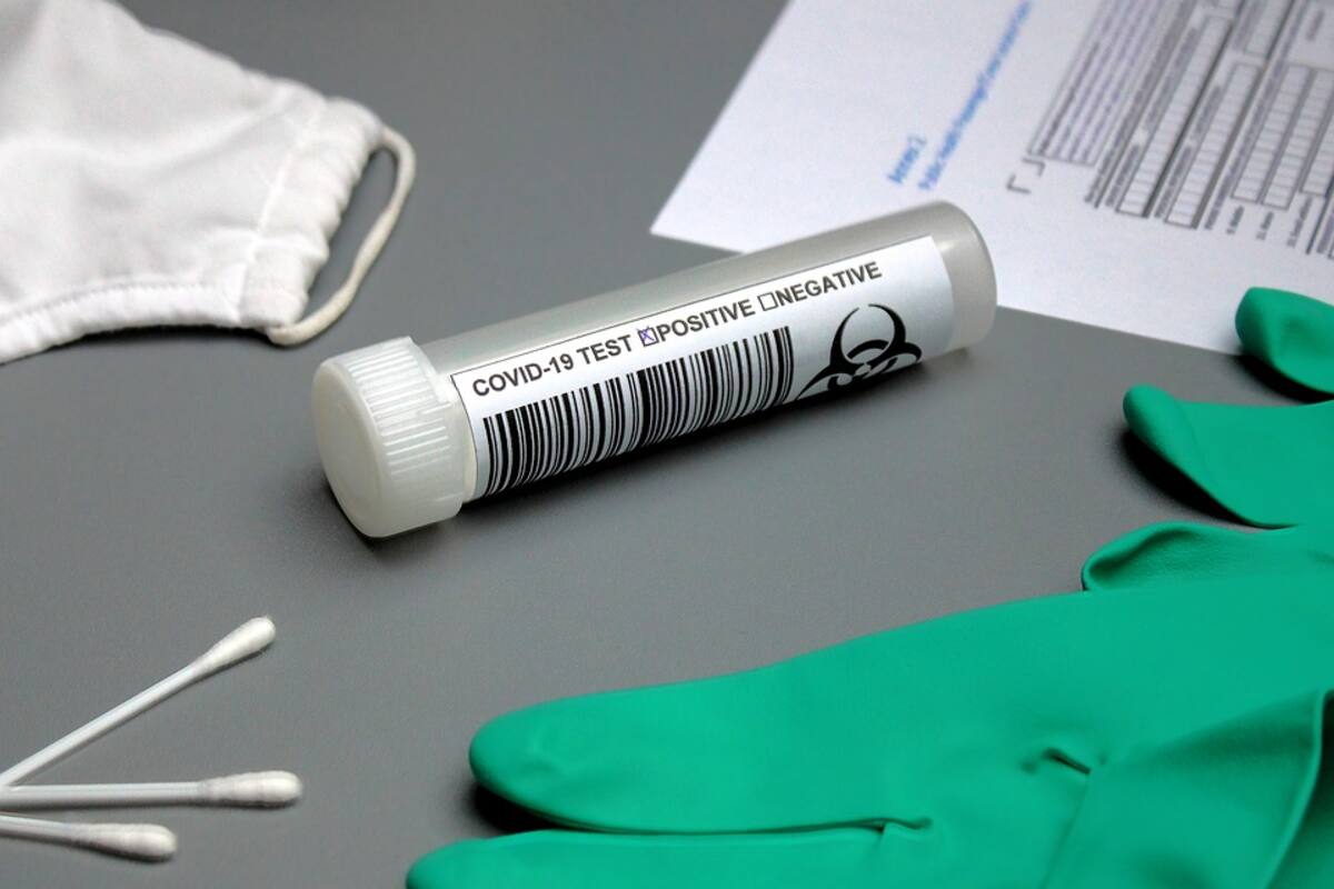 Centros comerciales y farmacias de CDMX se preparan para aplicar pruebas Covid-19