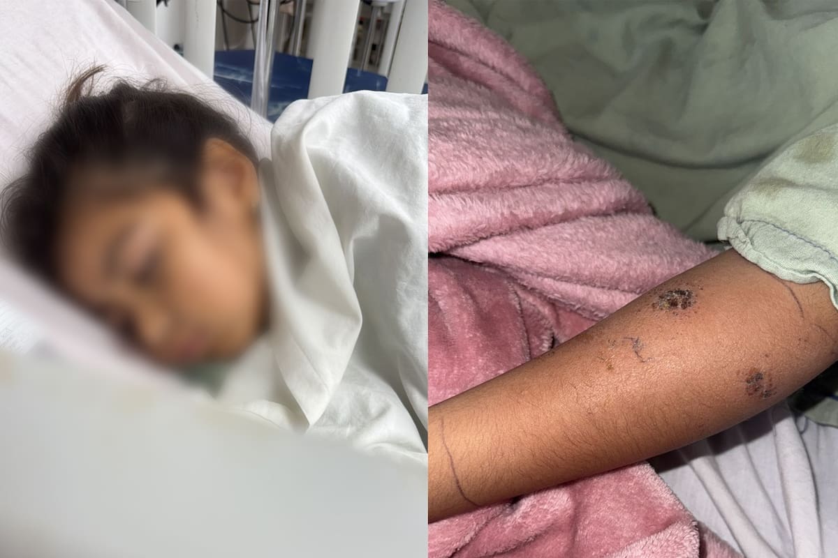 Internan a estudiante presuntamente picada por araña violinista en la primaria Centenario de la Revolución