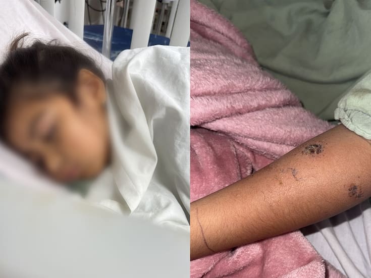 Internan a estudiante presuntamente picada por araña violinista en la primaria Centenario de la Revolución