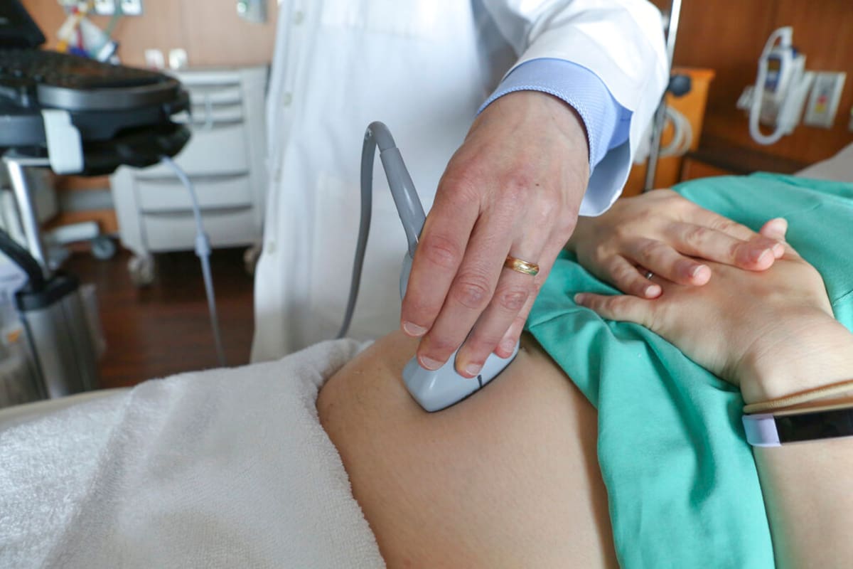 Fotografía de archivo del 7 de agosto de 2018 de un médico realizando un ultrasonido en una mujer embarazada en un hospital en Chicago. (AP Foto/Teresa Crawford, Archivo)