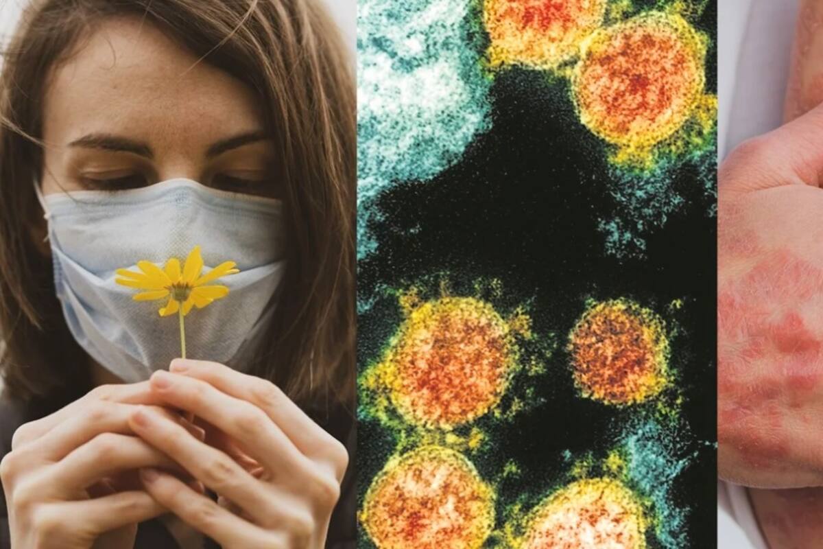 De fatiga a erupciones en la piel: Las secuelas de coronavirus, según CDC