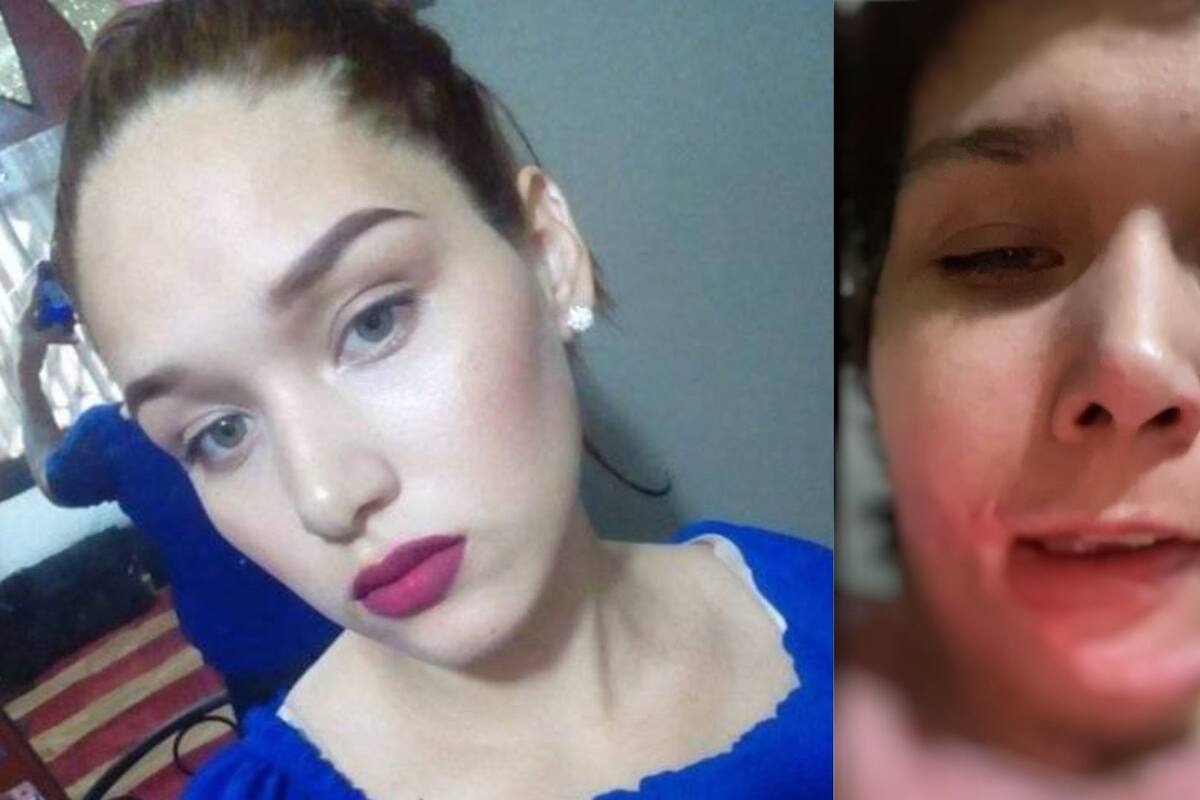 Tras seis meses de haber sido secuestrada, violada y quemada en Nuevo León, Liliana Fernández sigue sin recibir justicia