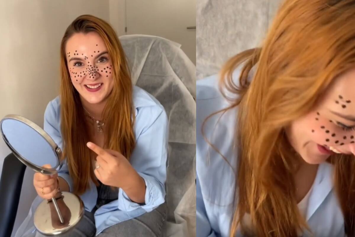 Joven le hace una broma a su amiga y le tatúa pecas mal hechas: mira su reacción