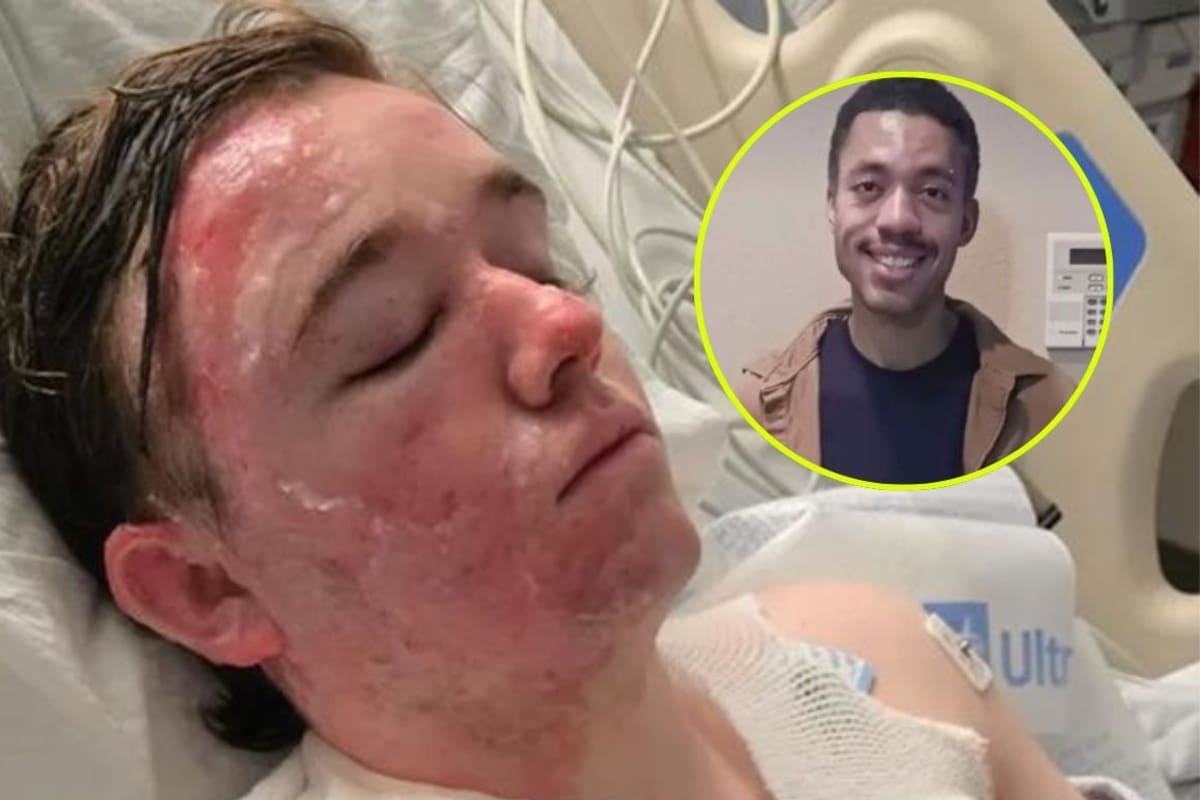 Empleado de McDonald’s termina en terapia intensiva tras ataque con aceite hirviendo de un compañero de trabajo