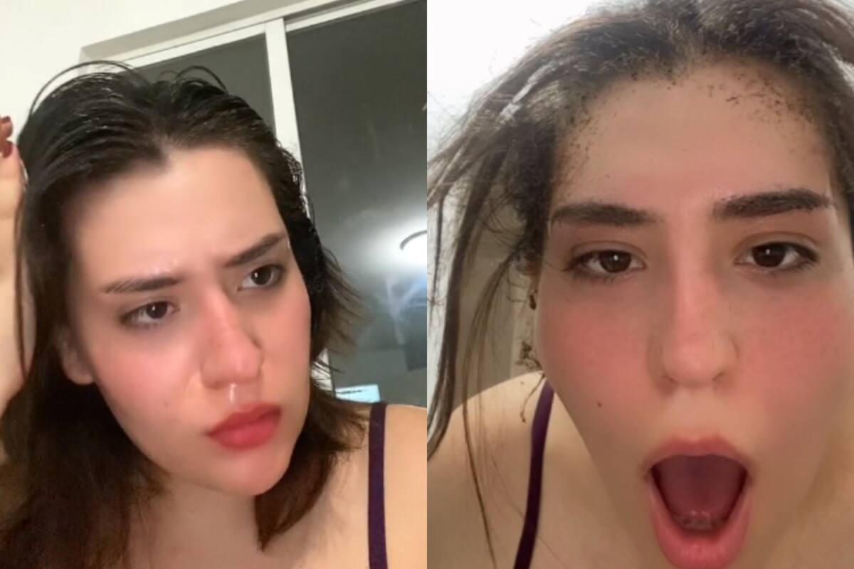 VIDEO | Joven es víctima de una explosión del boiler y comparte cómo quedó su cabello después del incidente