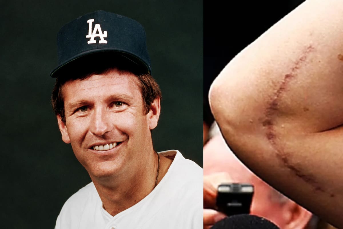 Muere Tommy John a los 83 años: el pitcher que dio nombre a la cirugía más famosa del beisbol