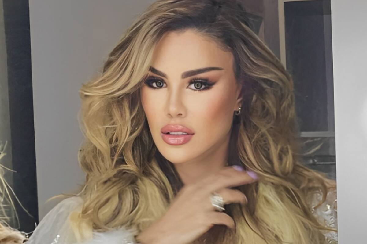 Ninel Conde luce nuevo rostro tras someterse a otro procedimiento estético