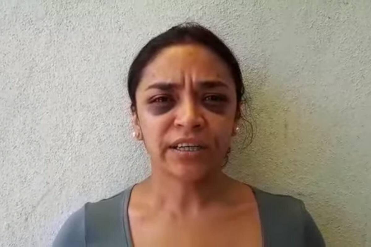Policías la golpearon cuando denunció intento de violación: Acusa reportera