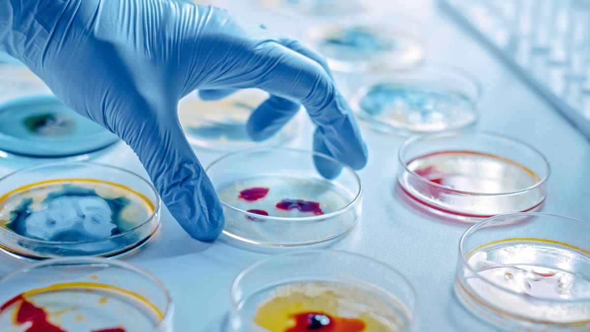 También puede propagarse por contacto con objetos contaminados o durante entierros inseguros.