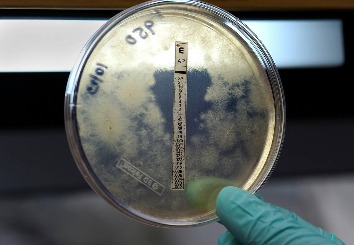 La mayoría de los casos de meningitis en los Estados Unidos se deben a una infección viral. FOTO: UNSPLASH