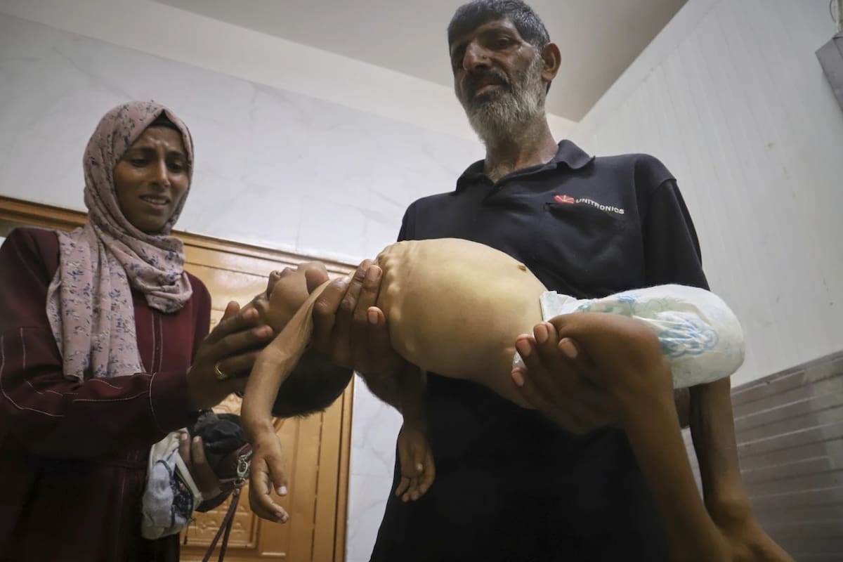 Islam Al-Najjar acaricia el cuerpo de su sobrino de 5 años, Jamal Al-Najjar, mientras su abuelo, Adnan Al-Najjar, lo lleva a prepararse para su funeral después de que muriera en el Hospital Nasser en Khan Younis, al sur de la Franja de Gaza, el martes 12 de agosto de 2025. El jefe de la unidad de pediatría de Nasser dijo que Jamal, que nació con raquitismo, murió de desnutrición severa. | Crédito: AP/Mariam Dagga