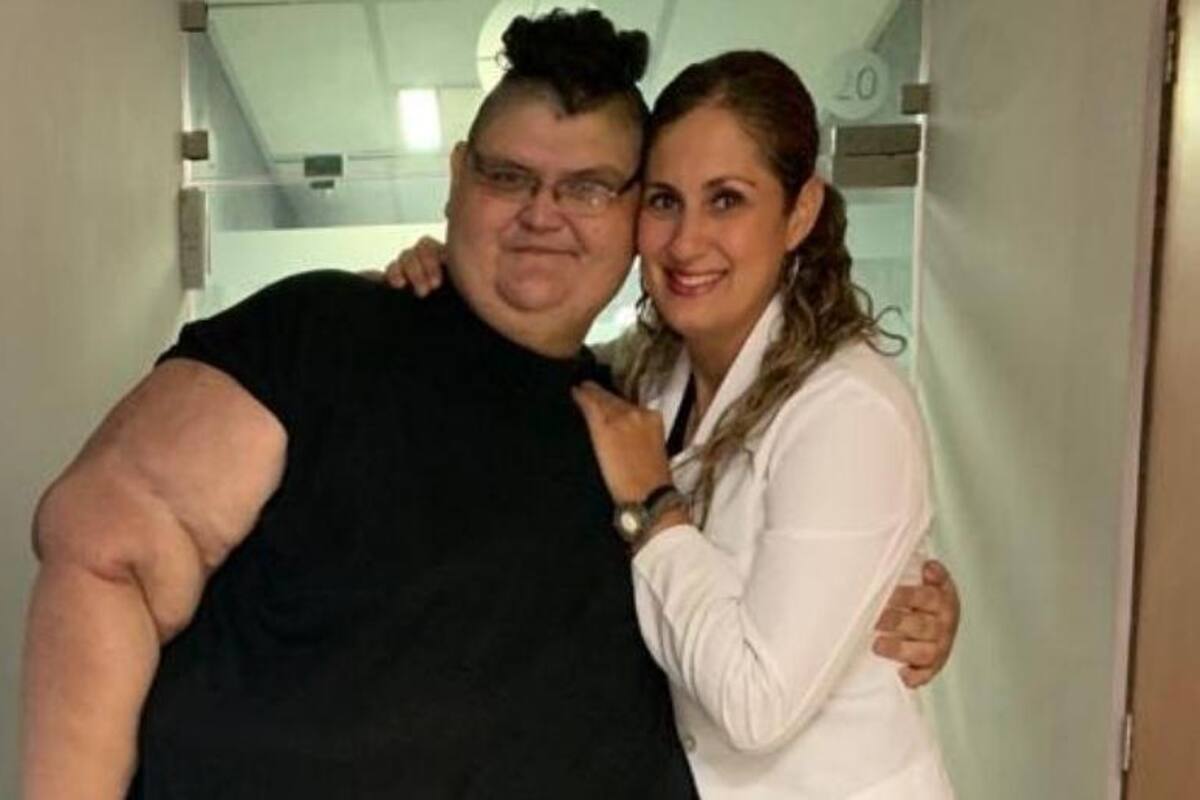 Vence al Covid-19 Juan Pedro Franco, mexicano que fue el más obeso del mundo
