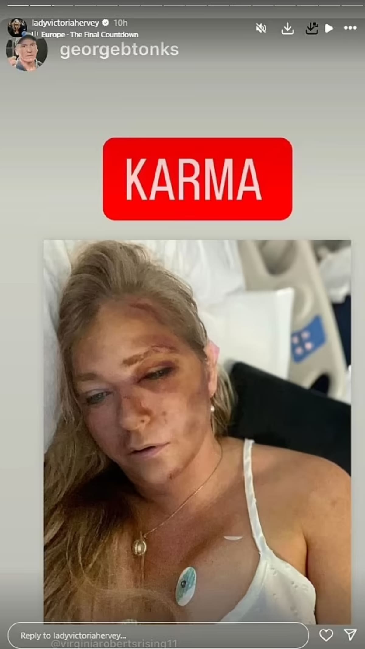 Virginia Giuffre, denunciante en el caso Epstein.