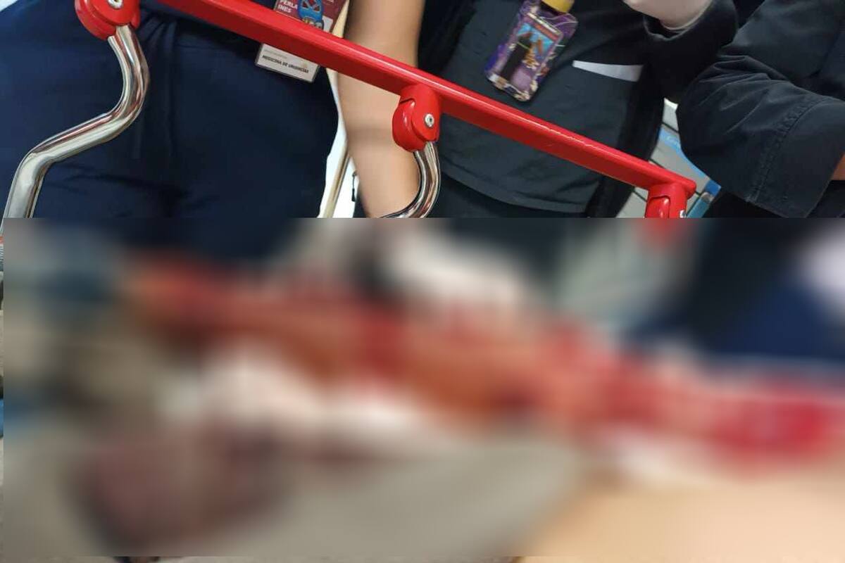 Atacan perros a hombre en Palaco