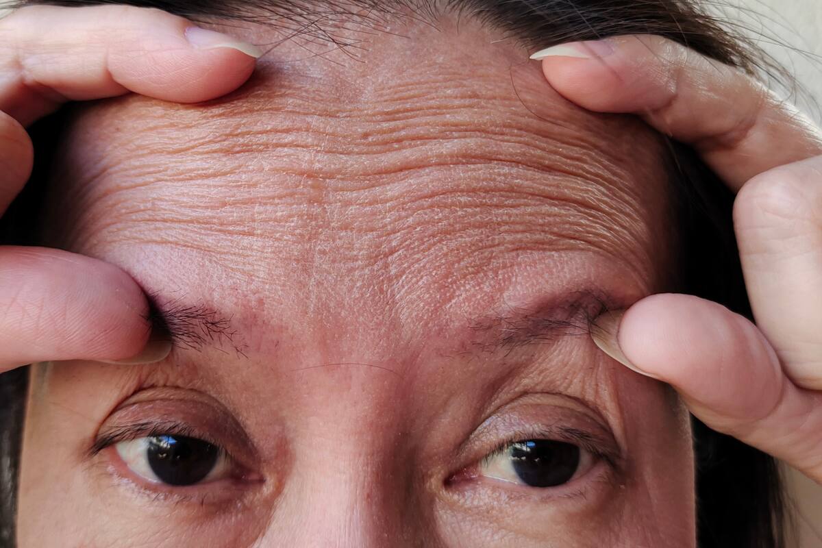 ¿Ha encontrado la ciencia por fin la solución a las arrugas y las canas? Científicos descubren un nuevo método para tratarlas