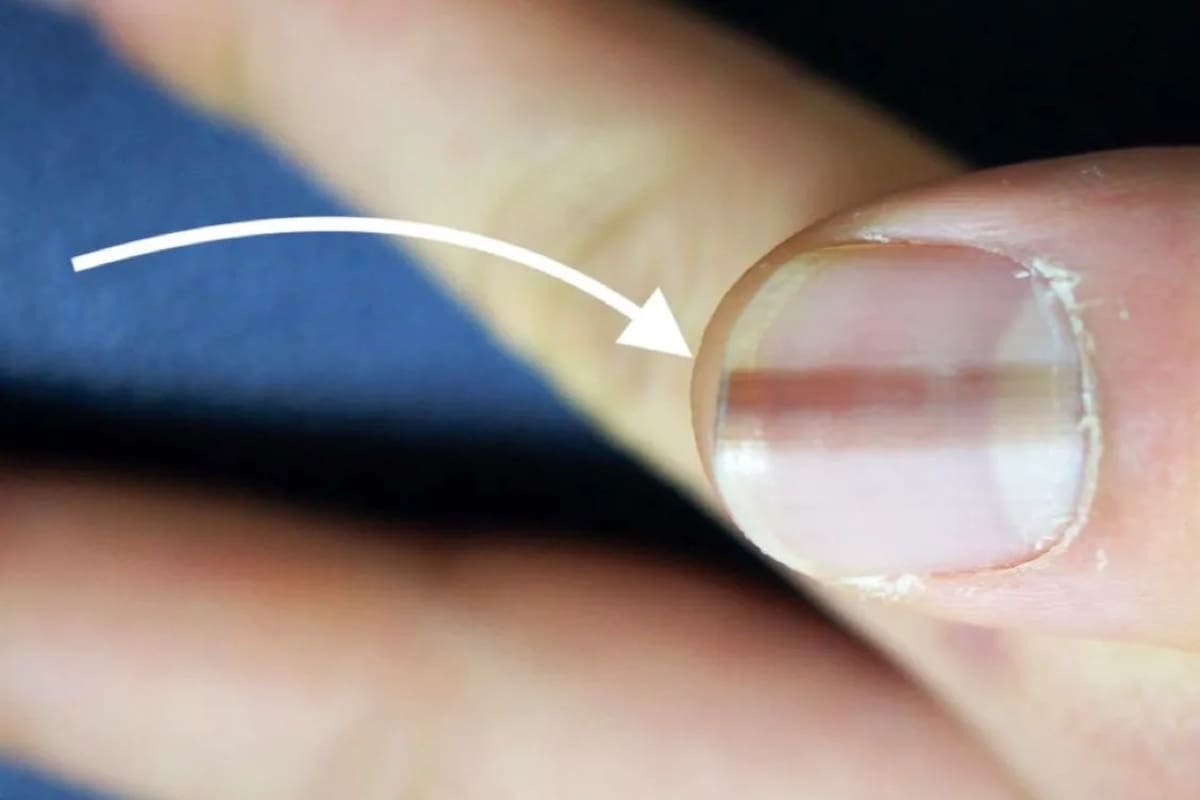 Síntomas raros que podrían ser señales de algo grave (y cuándo ir al médico)