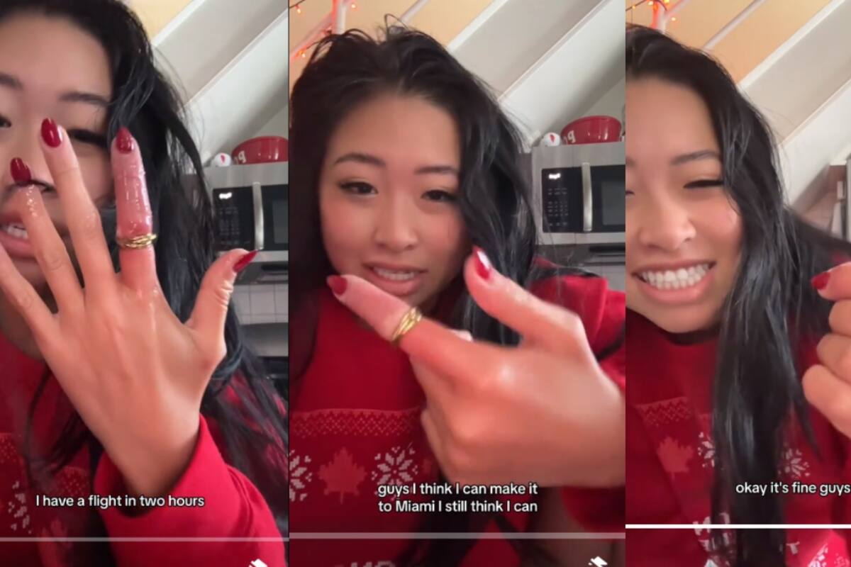 VIRAL: mujer casi pierde el dedo por un anillo atascado