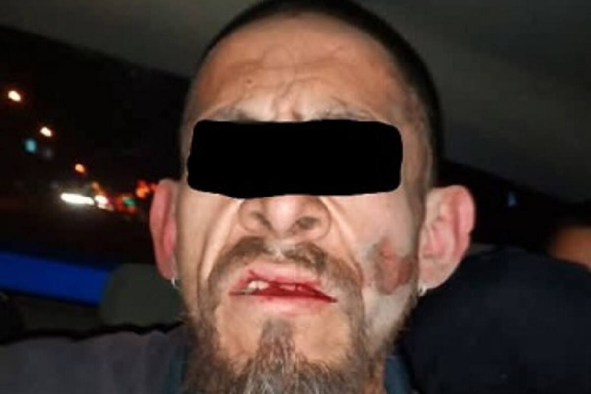 Agresor de Policía Municipal fue detenido tras balacera en González Ortega