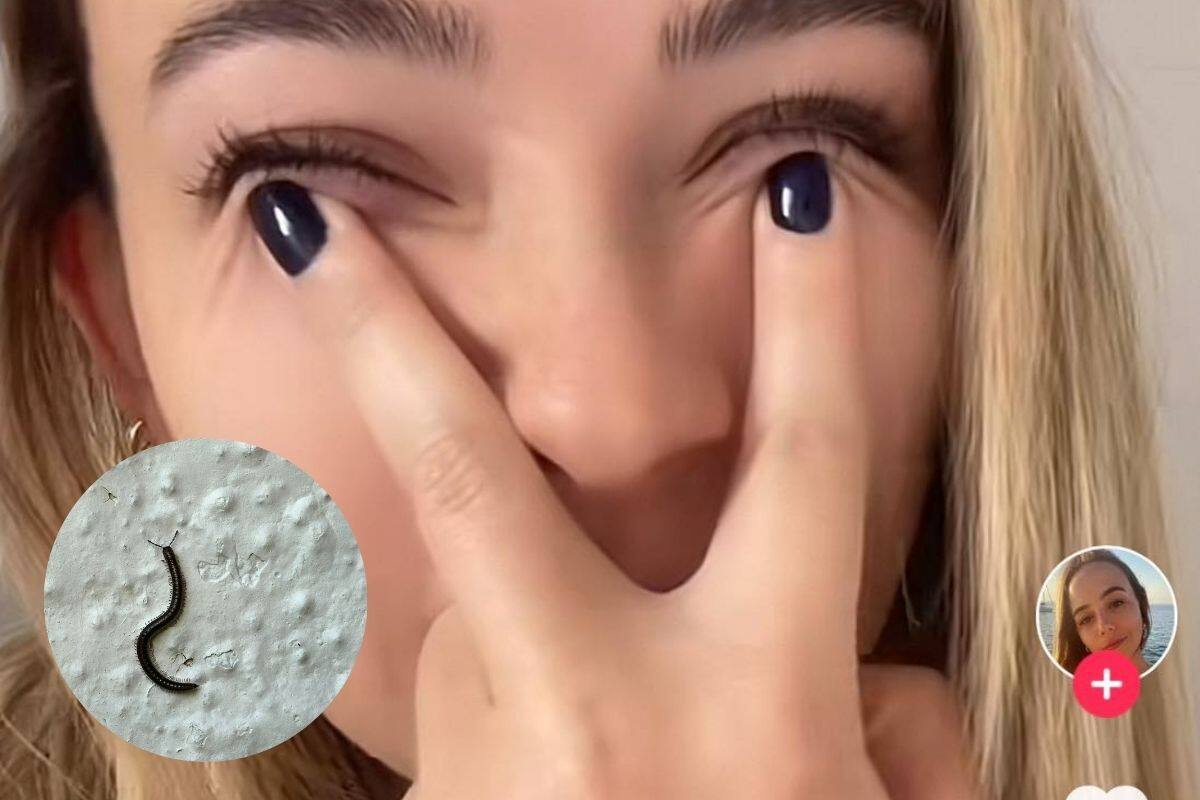 VIRAL: Tiktoker descubre que un gusano vivió en su ojo durante 4 años; lo confundió con una perilla